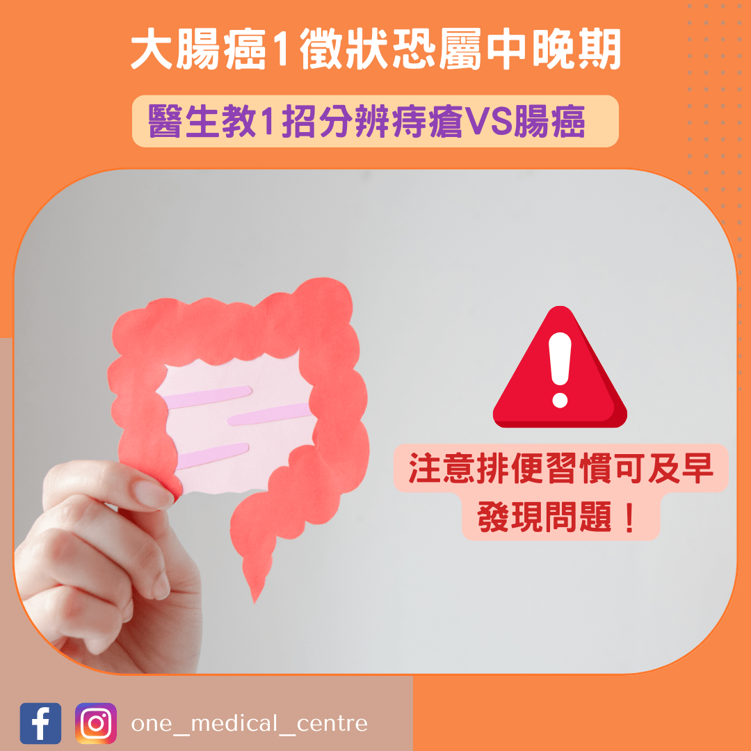 【大腸癌1徵狀恐屬中晚期　醫生教1招分辨痔瘡VS腸癌】